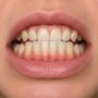 Bite from the front