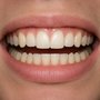 Smile from the front